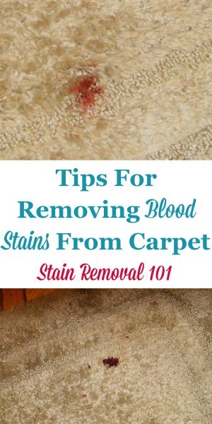 Tips for removing blood stains from carpet {on Stain Removal 101} #CarpetStains #StainRemoval #BloodStains