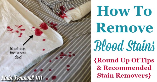 Here is a round up of tips and recommendations for stain removers when trying to figure out how to remove blood stains from clothing, carpet, upholstery, and other areas of your home {on Stain Removal 101}