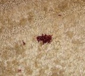blood stain in carpet