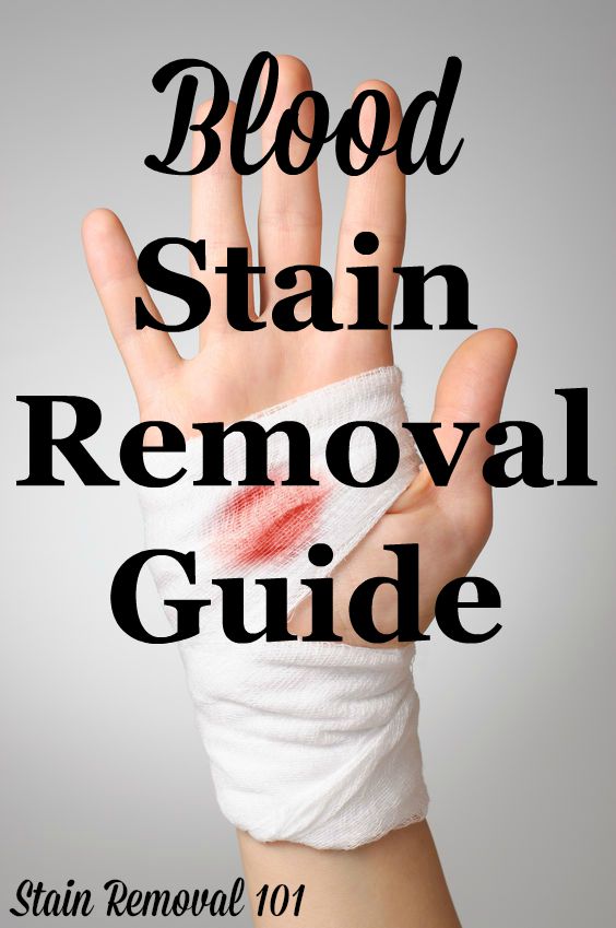Blood stain removal guide for clothes, upholstery and carpet {on Stain Removal 101}