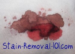 Blood Stain Removal Guide