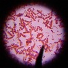 bacteria under microscope