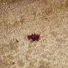 blood spot on carpet