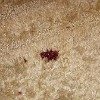 blood stain in carpet