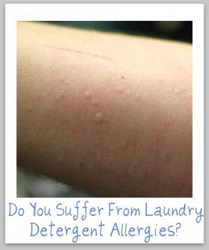 allergia ai detersivi per il bucato