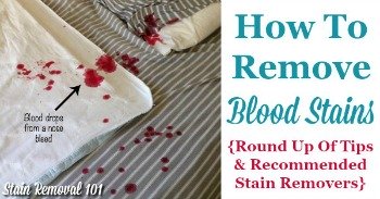 Tips for how to remove blood stains