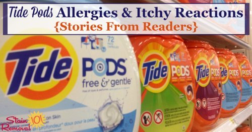 Here are stories from readers about Tide Pods allergies and itchy reactions they've experienced, plus recommendations about what to do about it {on Stain Removal 101} #TidePods #LaundryAllergies #AllergicReactions