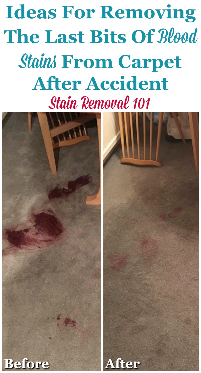 Tips for removing blood stains from carpet, including answering reader questions about removing these tough spots and drips {on Stain Removal 101} #BloodStainRemoval #CarpetStainRemoval #StainRemoval