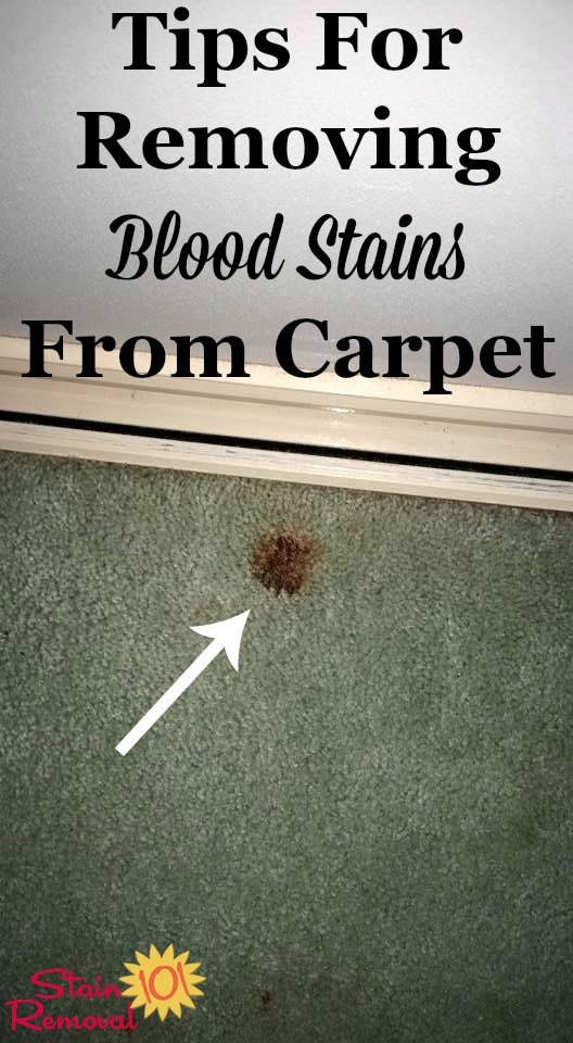 Tips for removing blood stains from carpet {on Stain Removal 101} #CarpetStains #BloodStains #StainRemoval