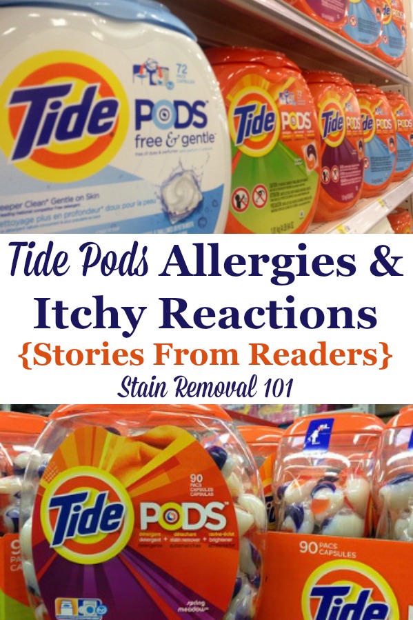 Here are stories from readers about Tide Pods allergies and itchy reactions they've experienced, plus recommendations about what to do about it {on Stain Removal 101} #TidePods #LaundryAllergies #AllergicReactions